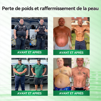 🍀Boutique Officielle🧑‍⚕️🩺Patch Minceur Solaroza® 10-en-1 : Relancez le Métabolisme et Brûlez les Graisses (NAD+ & Berbérine)
